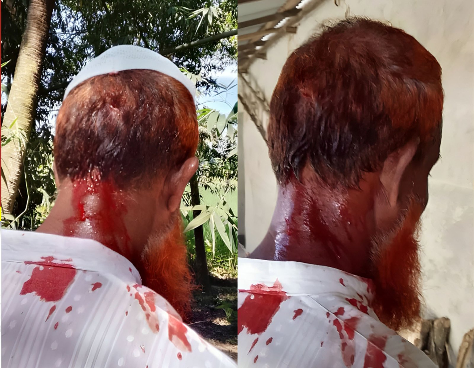 গফরগাঁওয়ে জামায়াতের গণসংযোগে বিএনপির হামলা, সহ-সভাপতি-সেক্রেটারিসহ আহত ৭